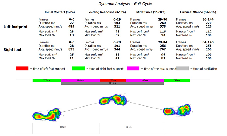 Printout of foot pressure dynamic analysis